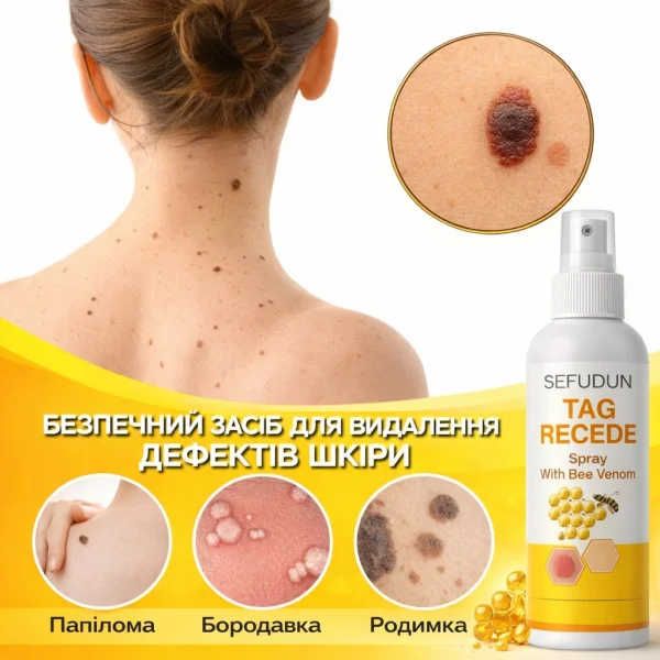 СПРЕЙ ВІД ПАПІЛОМ ТА БОРОДАВОК